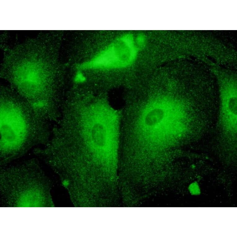 Immunoflouroscence - Anti-RAB27 Antibody (AB7223) - Antibodies.com