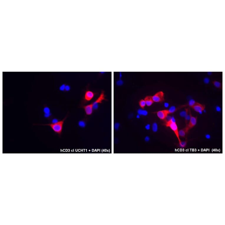 Immunocytochemistry - Anti-CD3 Antibody [TB3] (A121789) - Antibodies.com