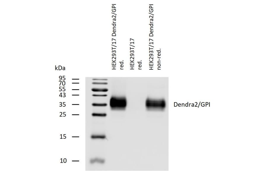 WB - Anti-DENDRA2 Antibody (A121799)