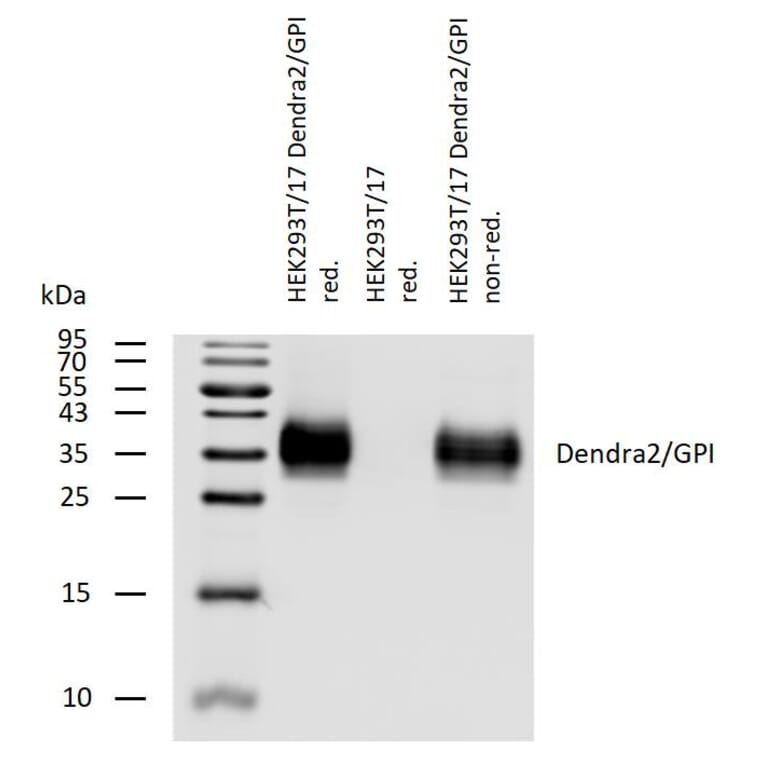 WB - Anti-DENDRA2 Antibody (A121799)