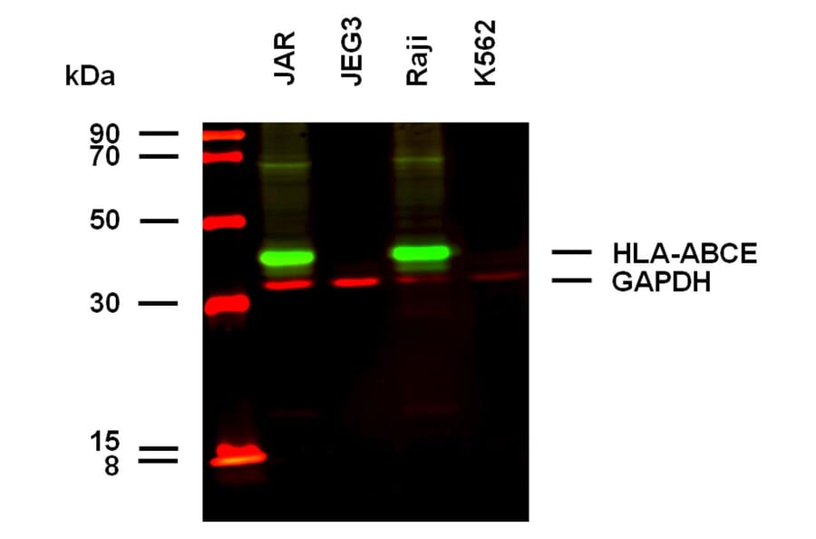 WB - Anti-HLA ABCE Antibody [TP25.99SF] (A121800)
