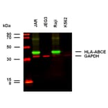 WB - Anti-HLA ABCE Antibody [TP25.99SF] (A121800)