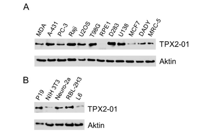 Western Blot - Anti-TPX2 Antibody [TPX2-01] (A121811) - Antibodies.com