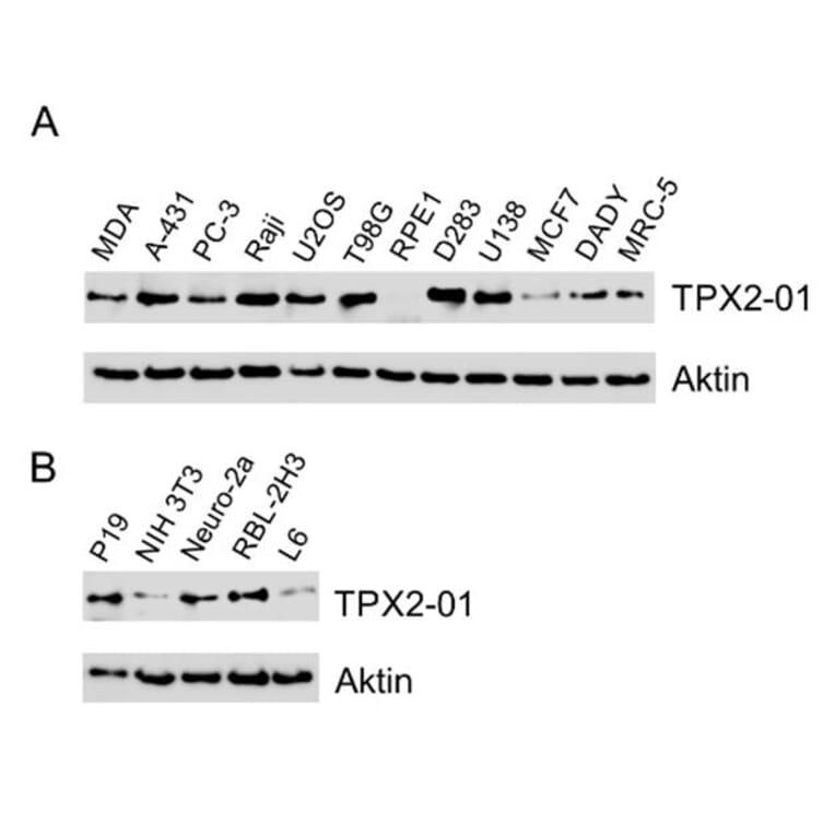Western Blot - Anti-TPX2 Antibody [TPX2-01] (A121811) - Antibodies.com