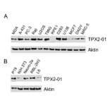 Western Blot - Anti-TPX2 Antibody [TPX2-01] (A121811) - Antibodies.com