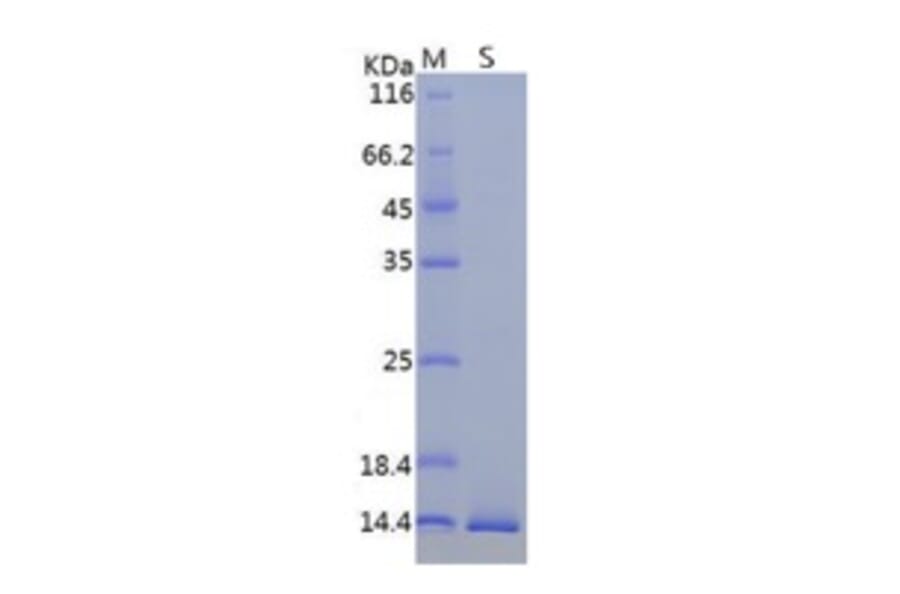 SDS-PAGE - Recombinant ORF8 Protein (a.a. 16-121) (His Tag) (A122153) - Antibodies.com