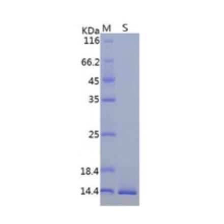 SDS-PAGE - Recombinant ORF8 Protein (a.a. 16-121) (His Tag) (A122153) - Antibodies.com