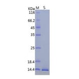 SDS-PAGE - Recombinant ORF8 Protein (a.a. 16-121) (His Tag) (A122153) - Antibodies.com