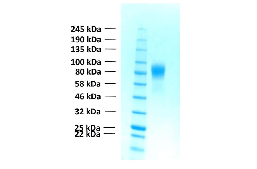 SDS-PAGE - Recombinant Human FGFR1b Protein (Functional) (A122154) - Antibodies.com