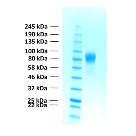 SDS-PAGE - Recombinant Human FGFR1b Protein (Functional) (A122154) - Antibodies.com