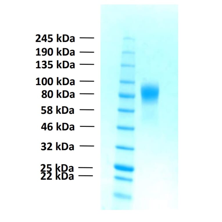 SDS-PAGE - Recombinant Human FGFR1b Protein (Functional) (A122154) - Antibodies.com