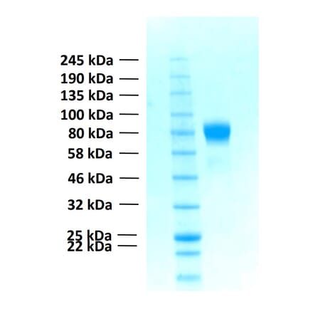 SDS-PAGE - Recombinant Human FGFR1c Protein (Functional) (A122155) - Antibodies.com