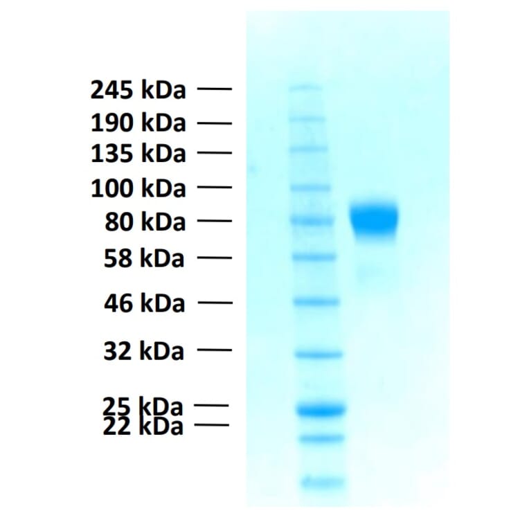 SDS-PAGE - Recombinant Human FGFR1c Protein (Functional) (A122155) - Antibodies.com