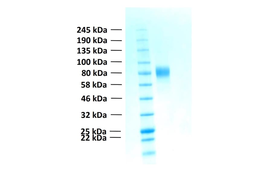 SDS-PAGE - Recombinant Human FGFR2b Protein (Functional) (A122156) - Antibodies.com