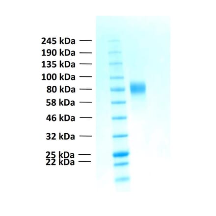 SDS-PAGE - Recombinant Human FGFR2b Protein (Functional) (A122156) - Antibodies.com