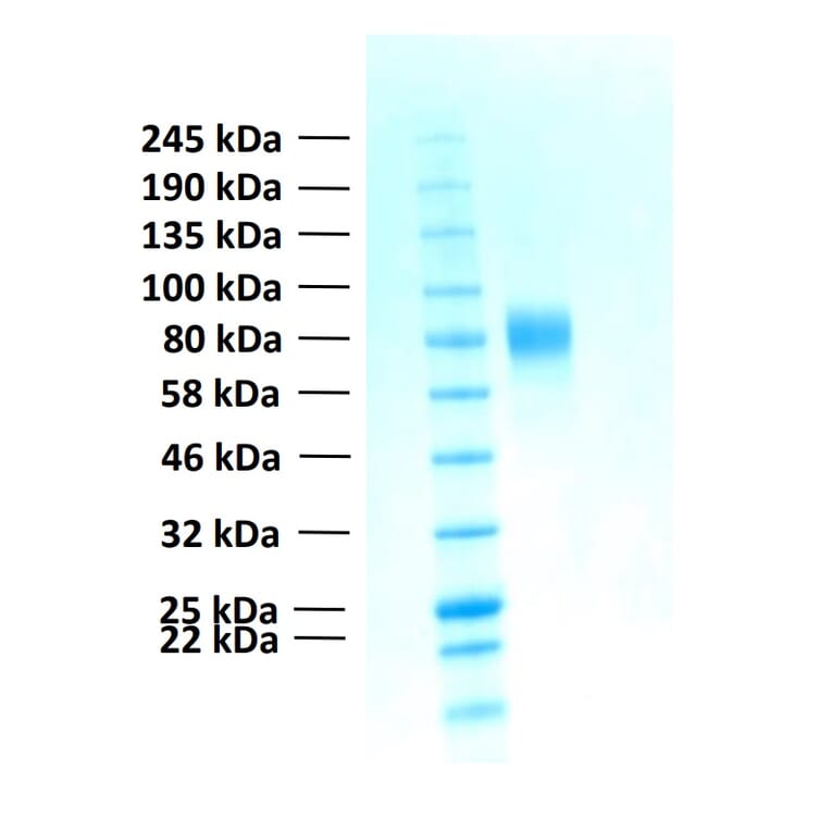 SDS-PAGE - Recombinant Human FGFR2b Protein (Functional) (A122156) - Antibodies.com