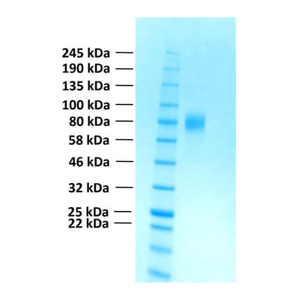 SDS-PAGE - Recombinant Human FGFR2c Protein (Functional) (A122157) - Antibodies.com