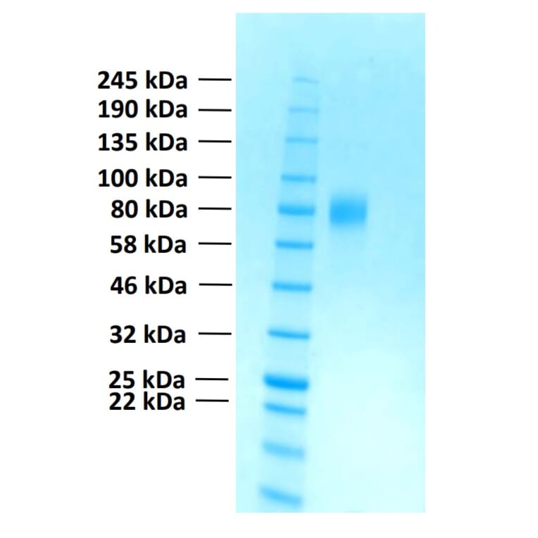 SDS-PAGE - Recombinant Human FGFR2c Protein (Functional) (A122157) - Antibodies.com