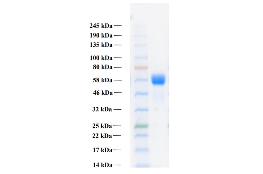 SDS-PAGE - Recombinant Human FGFR3b Protein (Functional) (A122158) - Antibodies.com