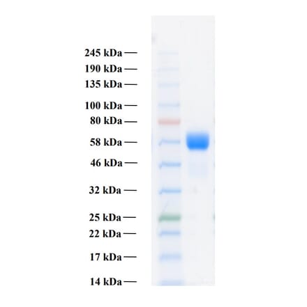 SDS-PAGE - Recombinant Human FGFR3b Protein (Functional) (A122158) - Antibodies.com