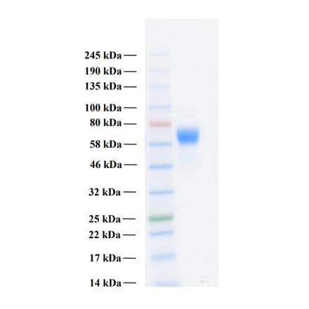SDS-PAGE - Recombinant Human FGFR3c Protein (Functional) (A122159) - Antibodies.com
