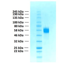 SDS-PAGE - Recombinant Human FGFR4 Protein (Functional) (A122160) - Antibodies.com