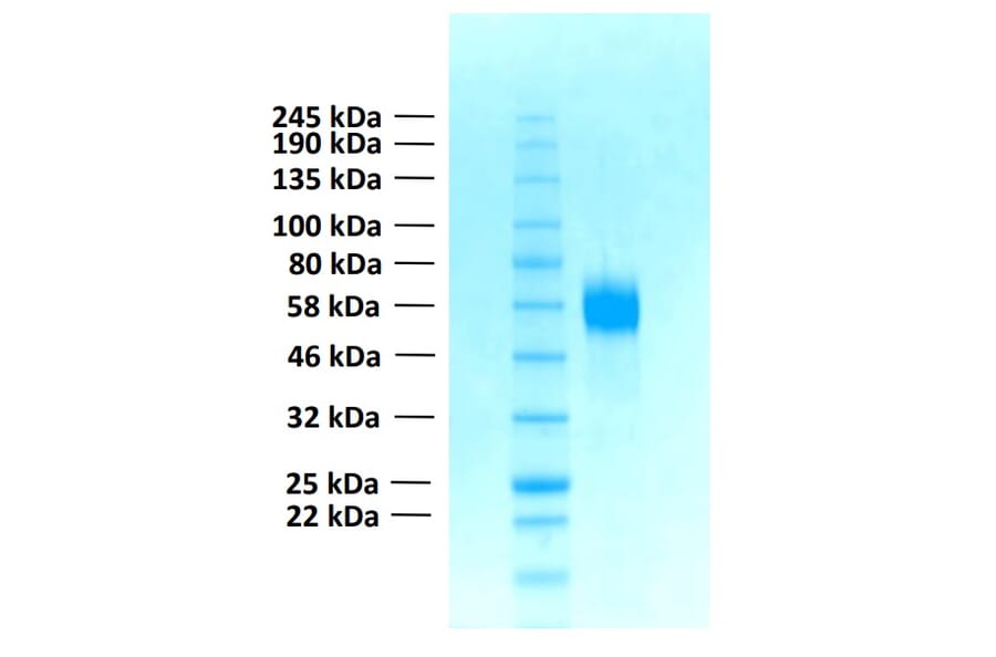 SDS-PAGE - Recombinant Human FGFR4 Protein (Functional) (A122160) - Antibodies.com