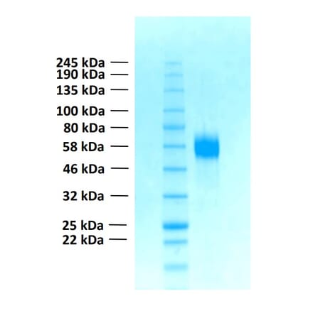 SDS-PAGE - Recombinant Human FGFR4 Protein (Functional) (A122160) - Antibodies.com