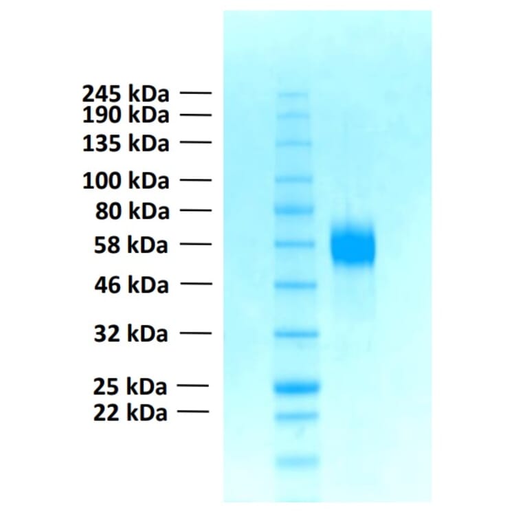 SDS-PAGE - Recombinant Human FGFR4 Protein (Functional) (A122160) - Antibodies.com