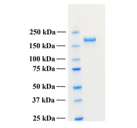 SDS-PAGE - Recombinant Human PLA2R1 Protein (Functional) (A122161) - Antibodies.com