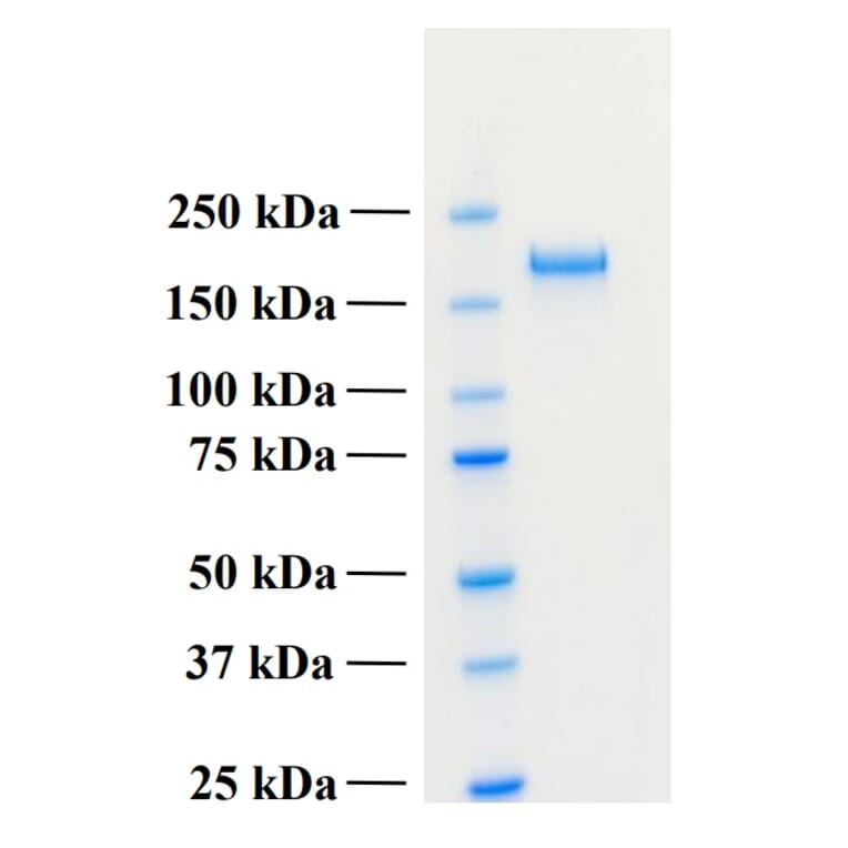 SDS-PAGE - Recombinant Human PLA2R1 Protein (Functional) (A122161) - Antibodies.com