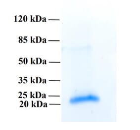 SDS-PAGE - Recombinant Human PLA2R1 Protein (Functional) (A122164) - Antibodies.com