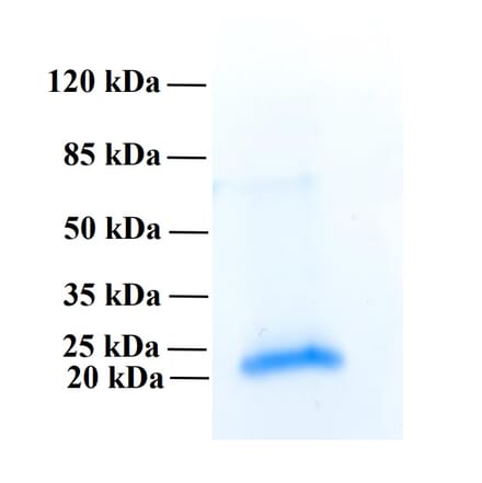 SDS-PAGE - Recombinant Human PLA2R1 Protein (Functional) (A122164) - Antibodies.com