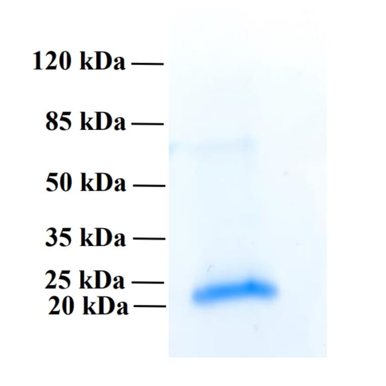 SDS-PAGE - Recombinant Human PLA2R1 Protein (Functional) (A122164) - Antibodies.com