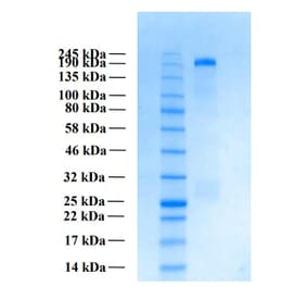 SDS-PAGE - Recombinant Human THSD7A Protein (Functional) (A122165) - Antibodies.com