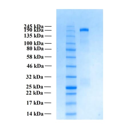 SDS-PAGE - Recombinant Human THSD7A Protein (Functional) (A122165) - Antibodies.com