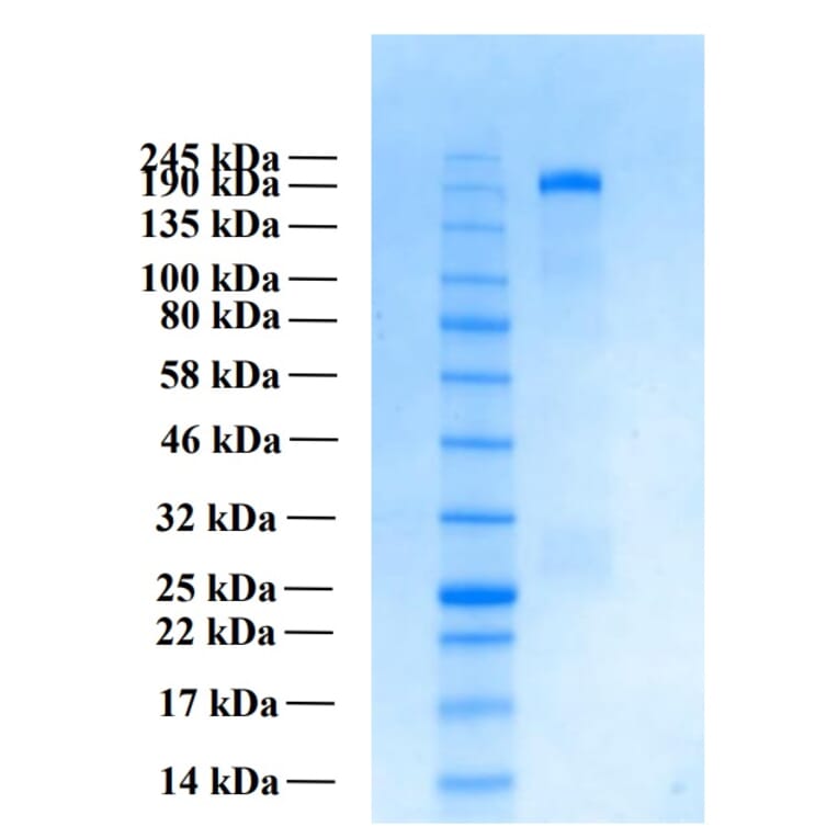 SDS-PAGE - Recombinant Human THSD7A Protein (Functional) (A122165) - Antibodies.com
