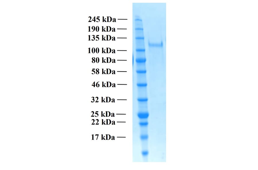 SDS-PAGE - Recombinant Human THSD7A Protein (Functional) (A122166) - Antibodies.com