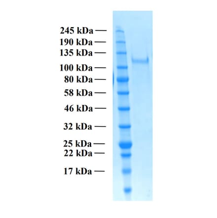 SDS-PAGE - Recombinant Human THSD7A Protein (Functional) (A122166) - Antibodies.com