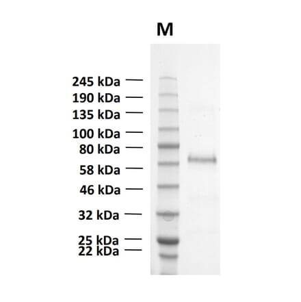 SDS-PAGE - Recombinant Human CD73 Protein (Functional) (A122168) - Antibodies.com