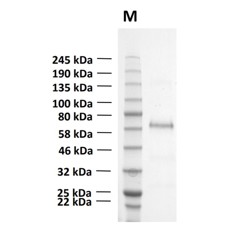 SDS-PAGE - Recombinant Human CD73 Protein (Functional) (A122168) - Antibodies.com