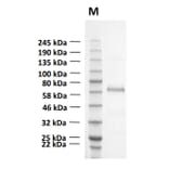 SDS-PAGE - Recombinant Human CD73 Protein (Functional) (A122168) - Antibodies.com