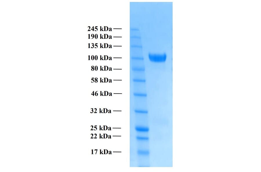 SDS-PAGE - Recombinant Human Amyloid Precursor Protein alpha (Functional) (A122169) - Antibodies.com