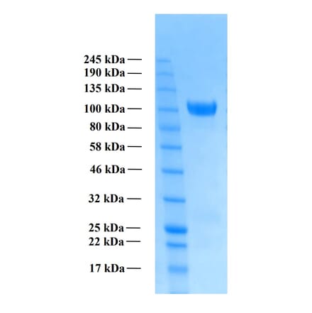 SDS-PAGE - Recombinant Human Amyloid Precursor Protein alpha (Functional) (A122169) - Antibodies.com