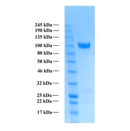 SDS-PAGE - Recombinant Human Amyloid Precursor Protein beta (Functional) (A122170) - Antibodies.com