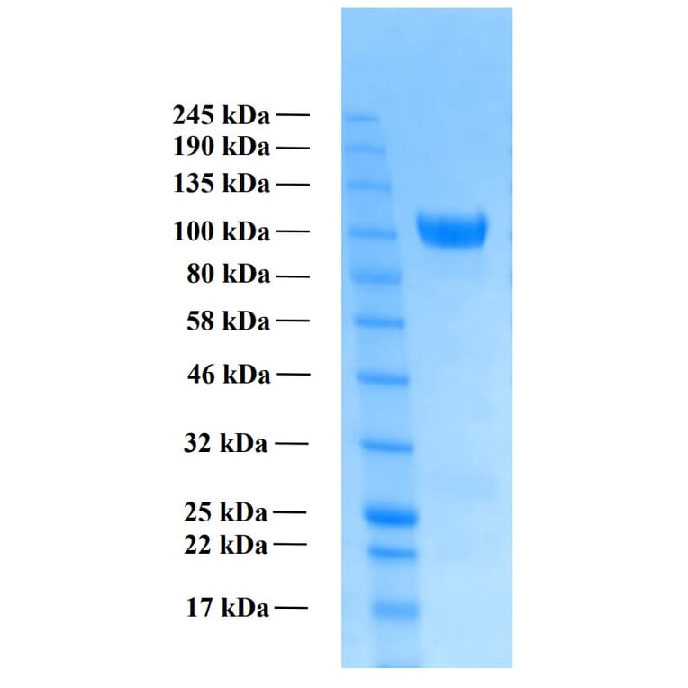 SDS-PAGE - Recombinant Human Amyloid Precursor Protein beta (Functional) (A122170) - Antibodies.com
