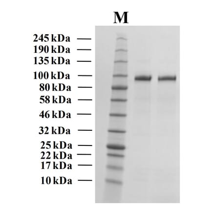 SDS-PAGE - Recombinant Human Autotaxin Protein (Functional) (A122171) - Antibodies.com