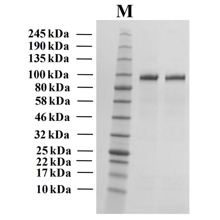 SDS-PAGE - Recombinant Human Autotaxin Protein (Functional) (A122171) - Antibodies.com