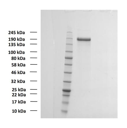 SDS-PAGE - Recombinant SARS-CoV-2 Spike Protein (D614G Variant) (Functional) (A122172) - Antibodies.com