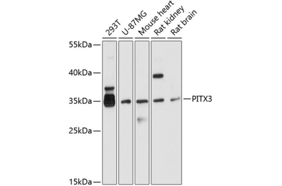 Western Blot - Anti-PITX3/PTX3 Antibody (A13000) - Antibodies.com